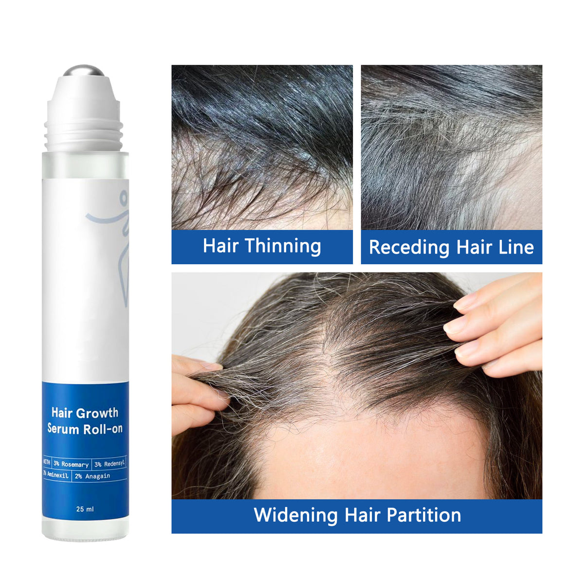 Hair Growth Serum RegenaLife Market